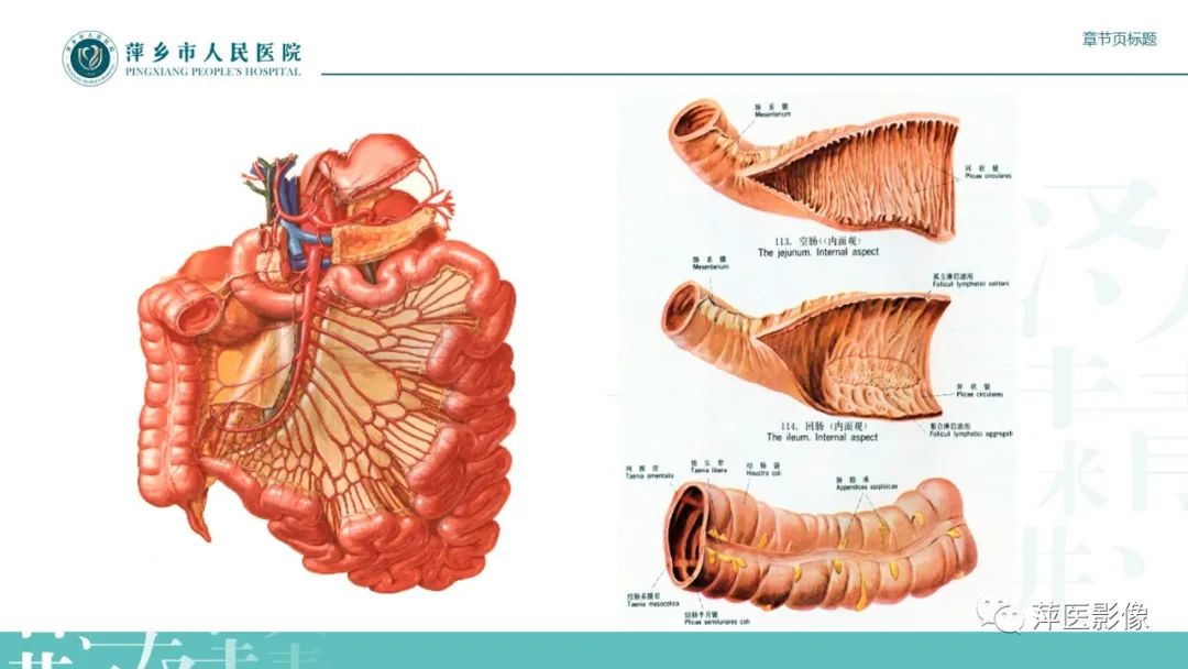 影像PPT - 【PPT】肠梗阻读片之小肠篇-4