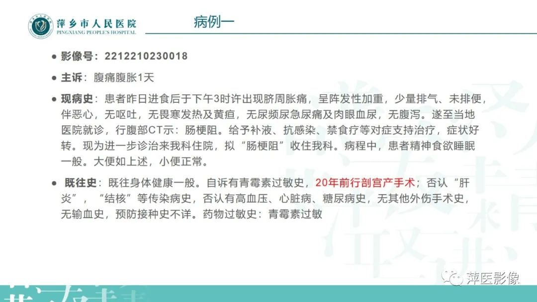 影像PPT - 【PPT】肠梗阻读片之小肠篇-50