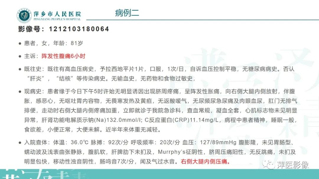 影像PPT - 【PPT】肠梗阻读片之小肠篇-53