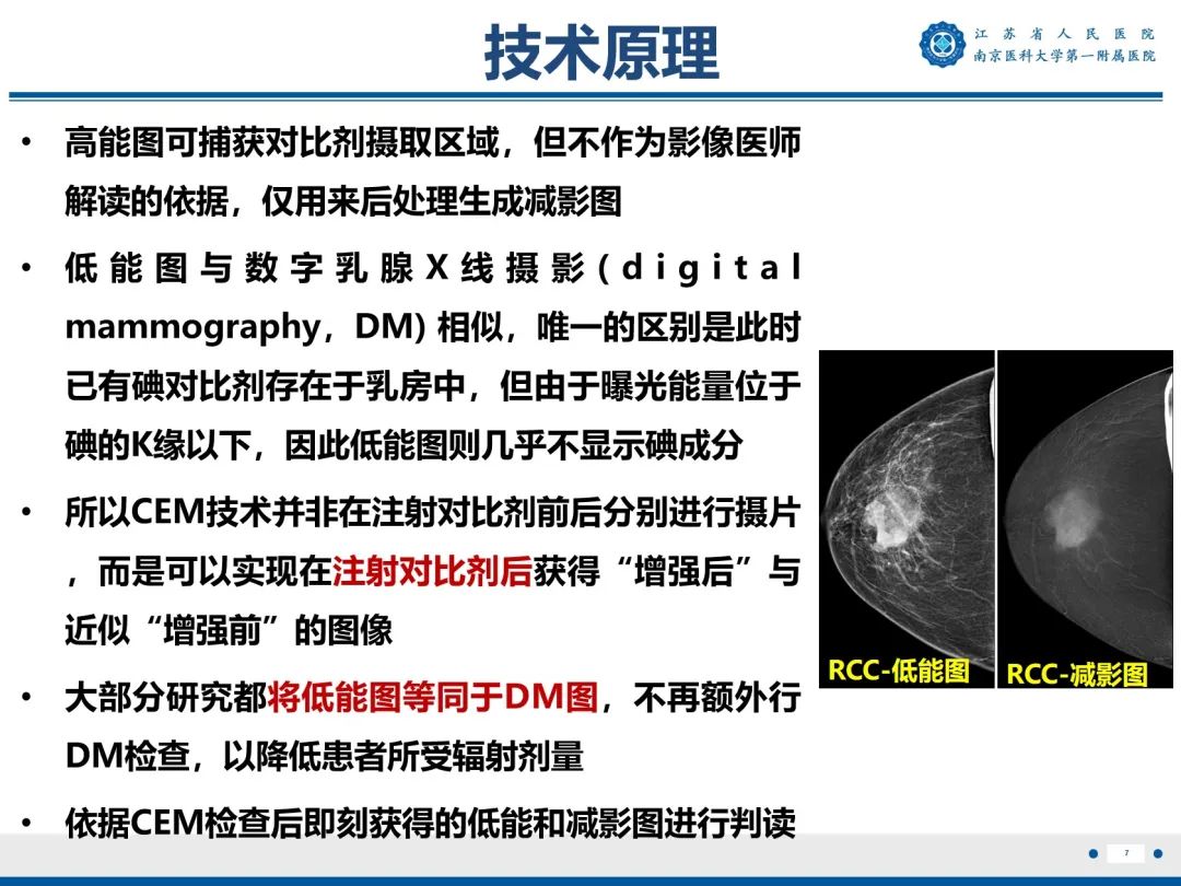 影像PPT - 【PPT】浸润性乳腺癌，非特殊类型-8