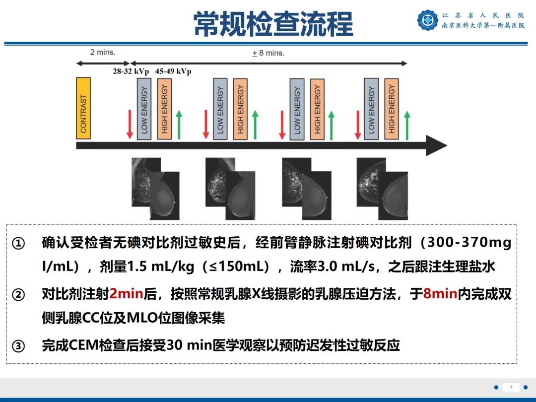 影像PPT - 【PPT】浸润性乳腺癌，非特殊类型-9