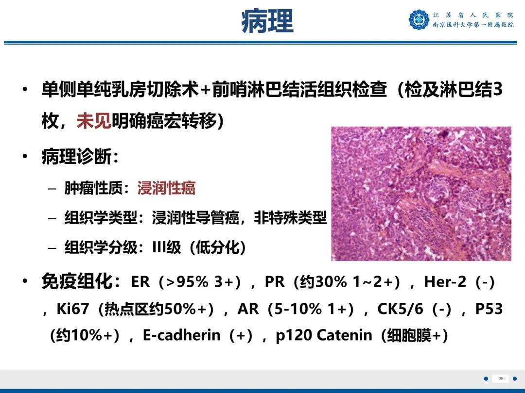影像PPT - 【PPT】浸润性乳腺癌，非特殊类型-36
