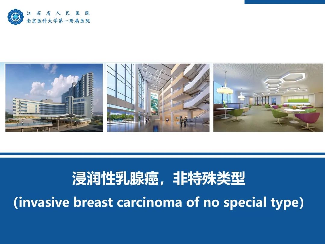 影像PPT - 【PPT】浸润性乳腺癌，非特殊类型-54