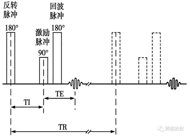 影像PPT - 液体衰减反转恢复(FLAIR)序列图像有何特点-1 影像PPT - 液体衰减反转恢复(FLAIR)序列图像有何特点-1