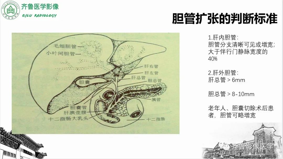 影像PPT - 【PPT】先天性胆管扩张症-4