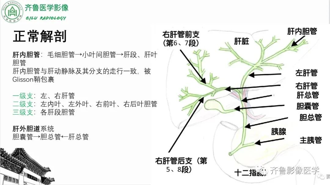 影像PPT - 【PPT】先天性胆管扩张症-2