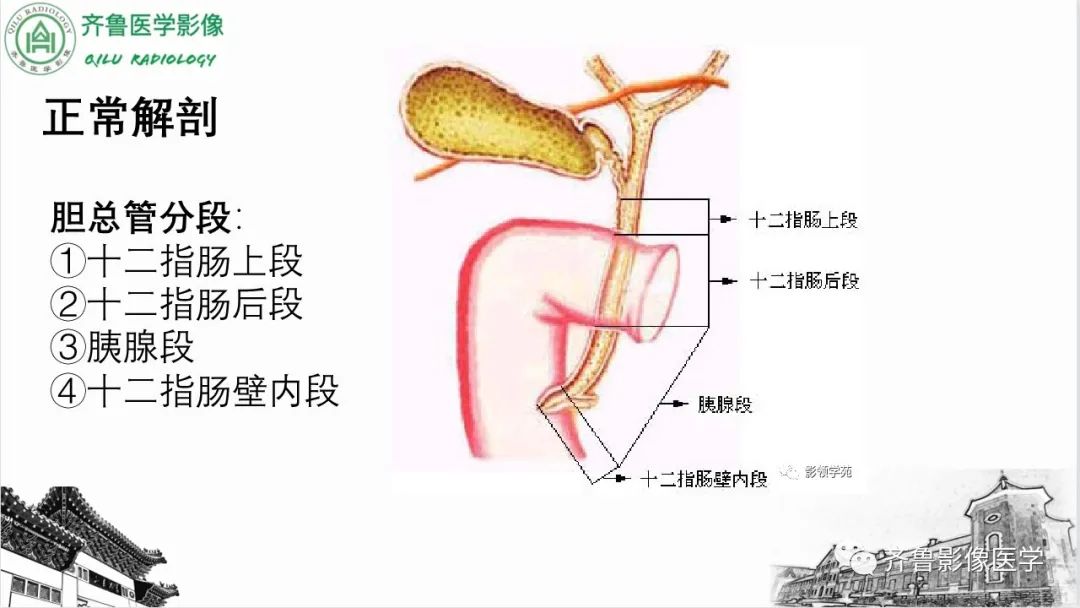 影像PPT - 【PPT】先天性胆管扩张症-3