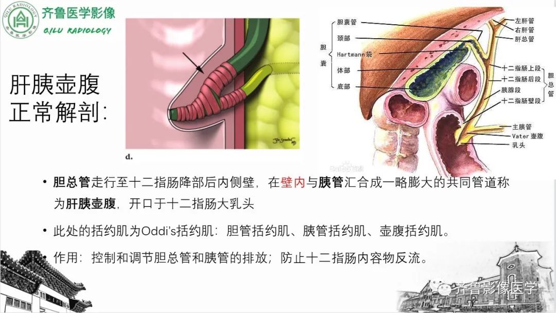 影像PPT - 【PPT】先天性胆管扩张症-7