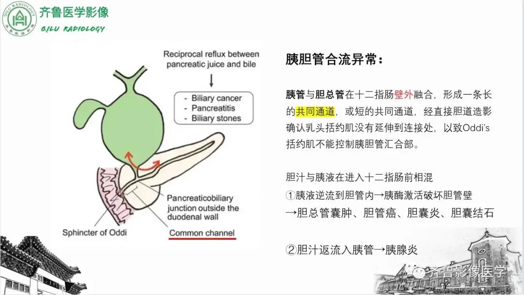影像PPT - 【PPT】先天性胆管扩张症-8