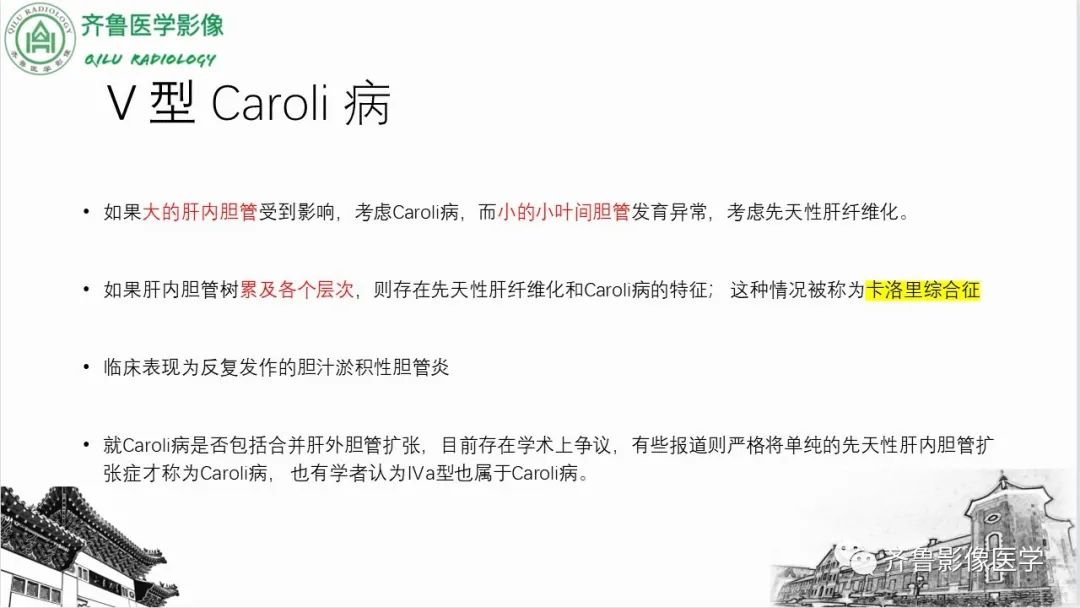 影像PPT - 【PPT】先天性胆管扩张症-21