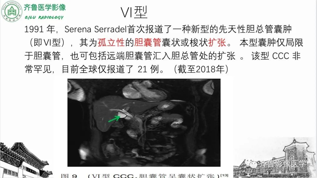 影像PPT - 【PPT】先天性胆管扩张症-27