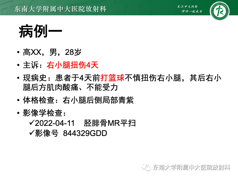 影像PPT - 【PPT】网球腿-2