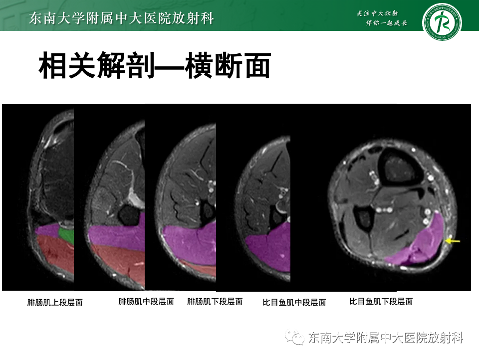 影像PPT - 【PPT】网球腿-9