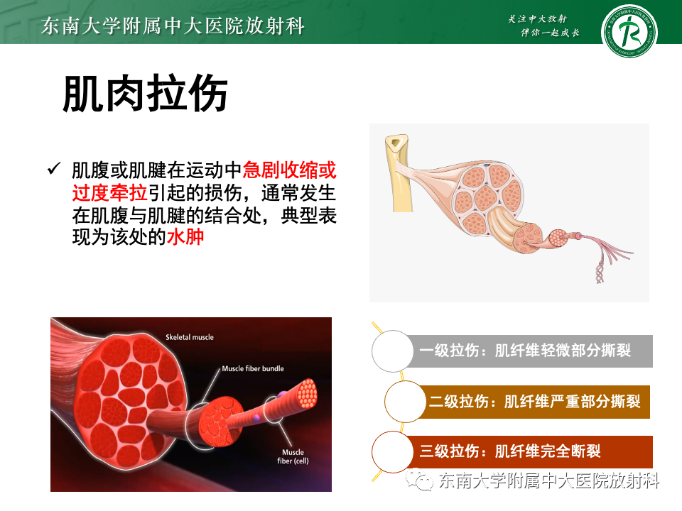 影像PPT - 【PPT】网球腿-13