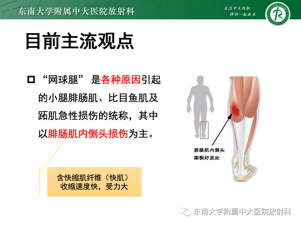 影像PPT - 【PPT】网球腿-15