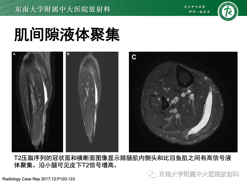 影像PPT - 【PPT】网球腿-20