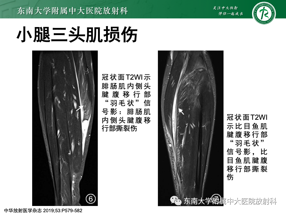 影像PPT - 【PPT】网球腿-23