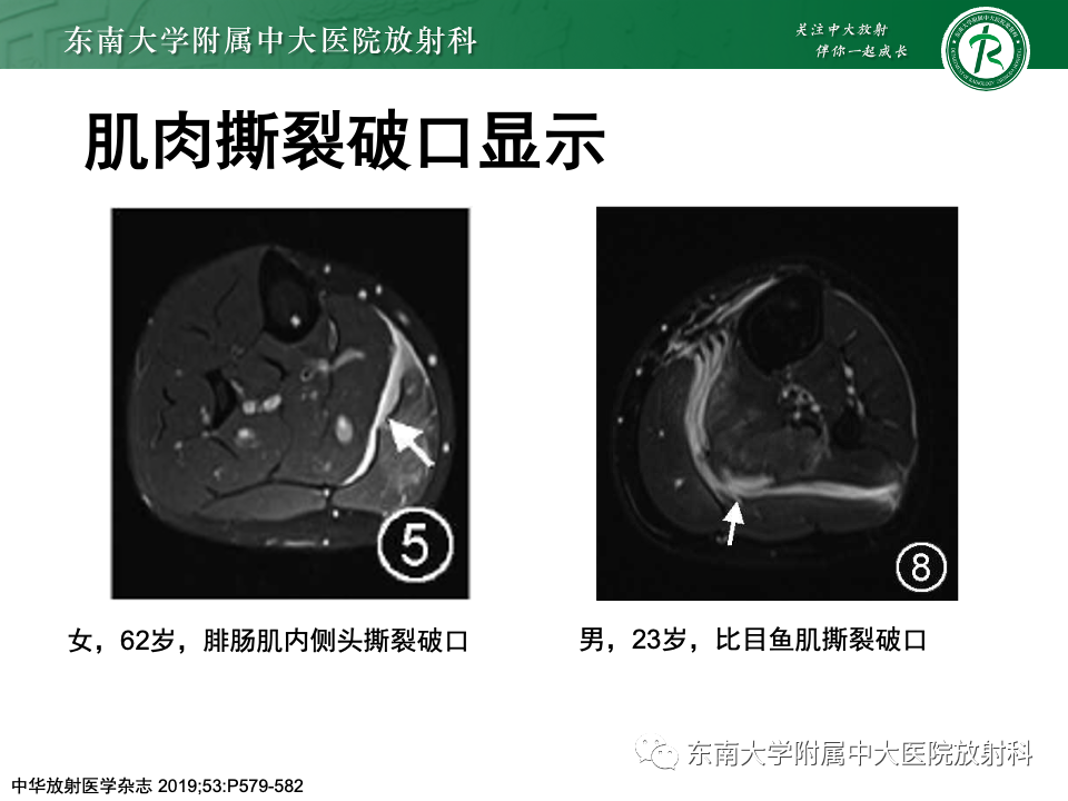 影像PPT - 【PPT】网球腿-24