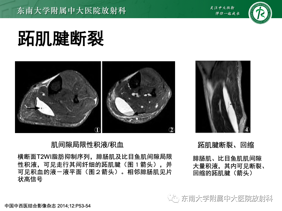 影像PPT - 【PPT】网球腿-25