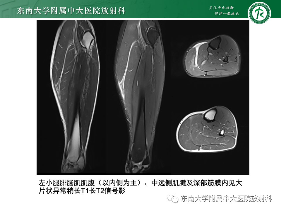 影像PPT - 【PPT】网球腿-27