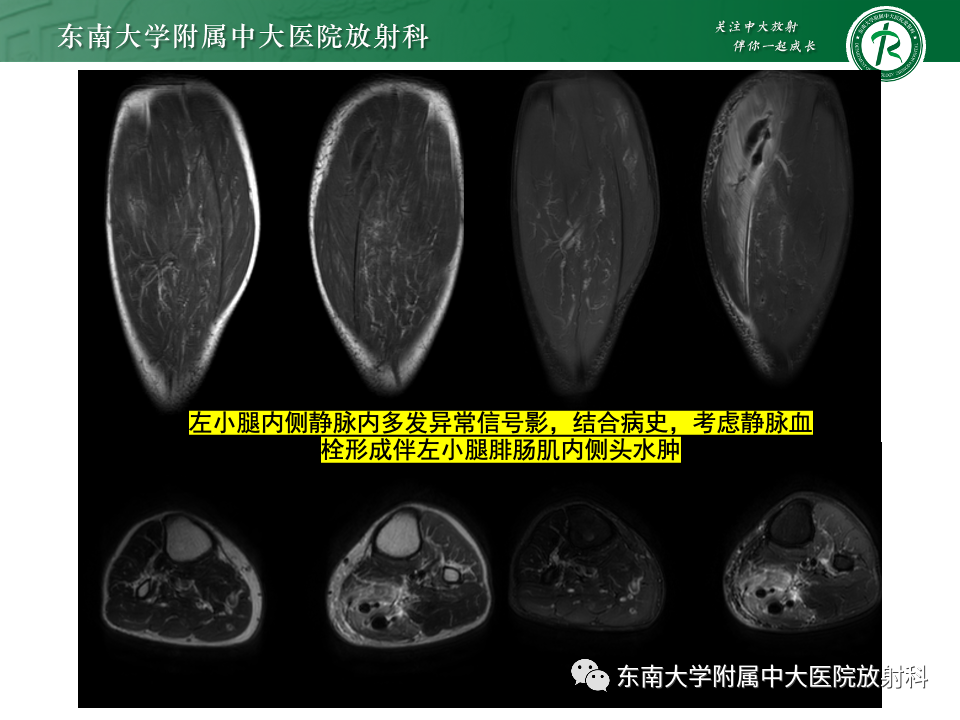 影像PPT - 【PPT】网球腿-31