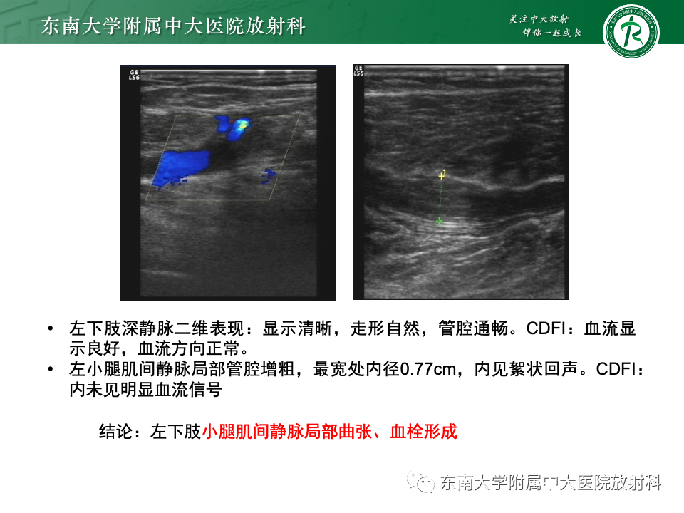 影像PPT - 【PPT】网球腿-32