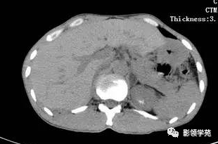 影像PPT - 梅花绽放征-4 影像PPT - 梅花绽放征-4