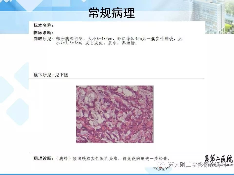 影像PPT - 【病例】胰腺囊性病变3例影像诊断-9