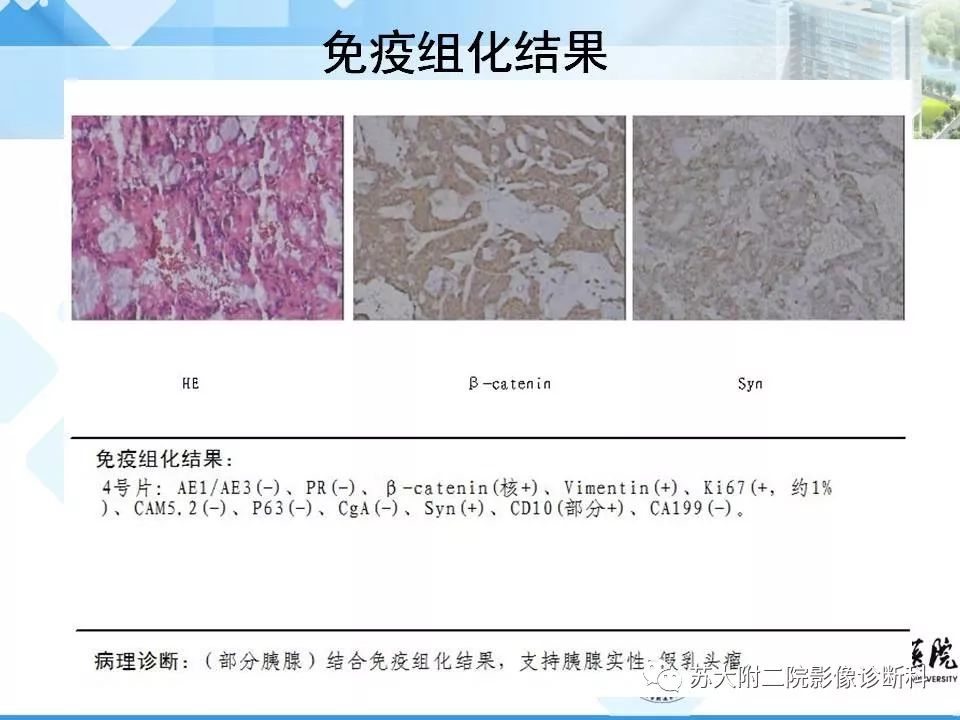 影像PPT - 【病例】胰腺囊性病变3例影像诊断-10