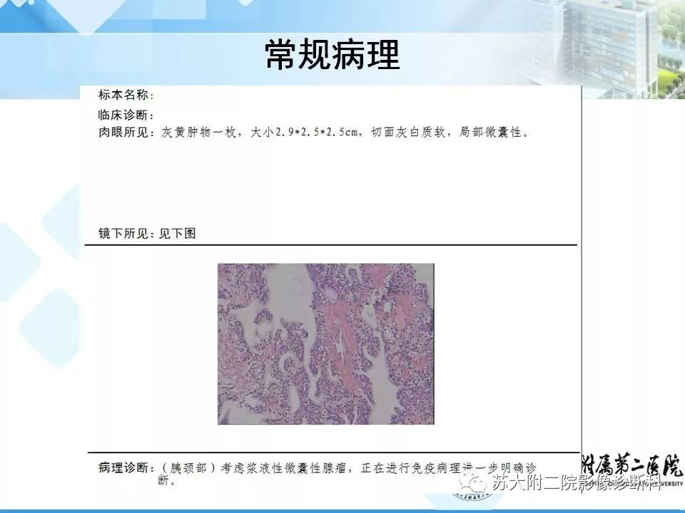 影像PPT - 【病例】胰腺囊性病变3例影像诊断-19