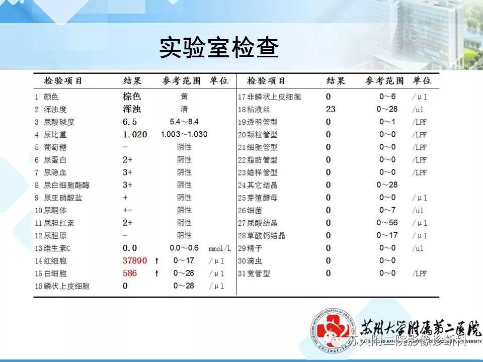 影像PPT - 【病例】胰腺囊性病变3例影像诊断-27