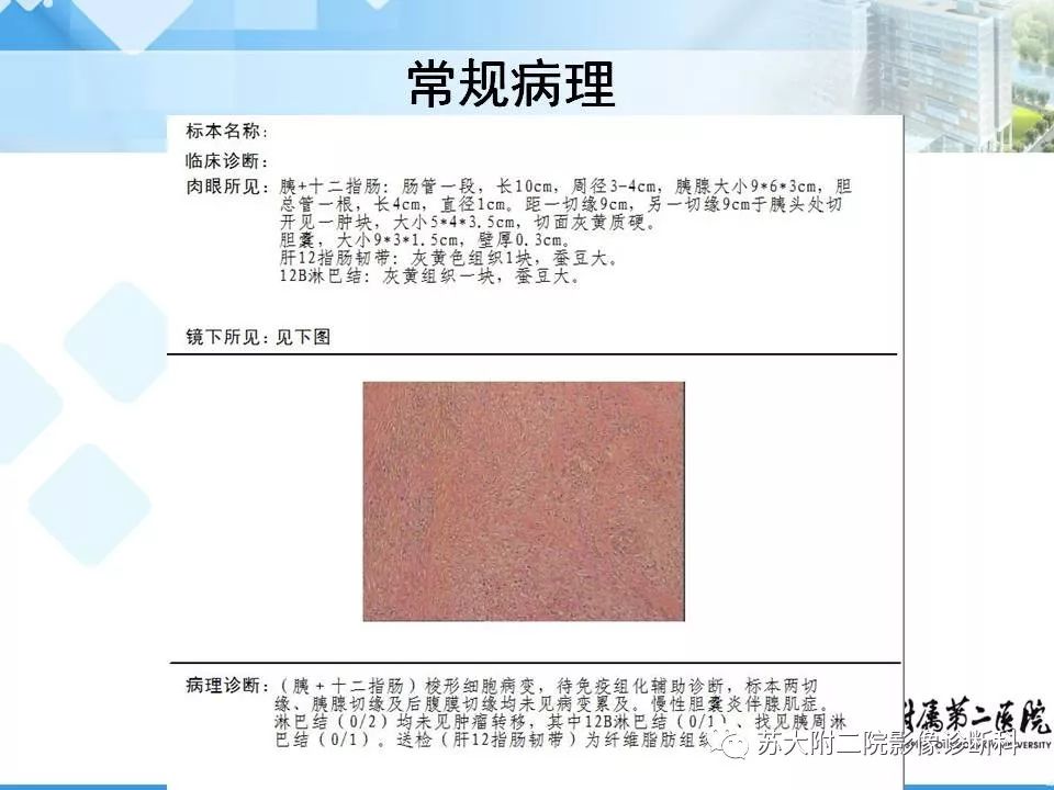 影像PPT - 【病例】胰腺囊性病变3例影像诊断-29