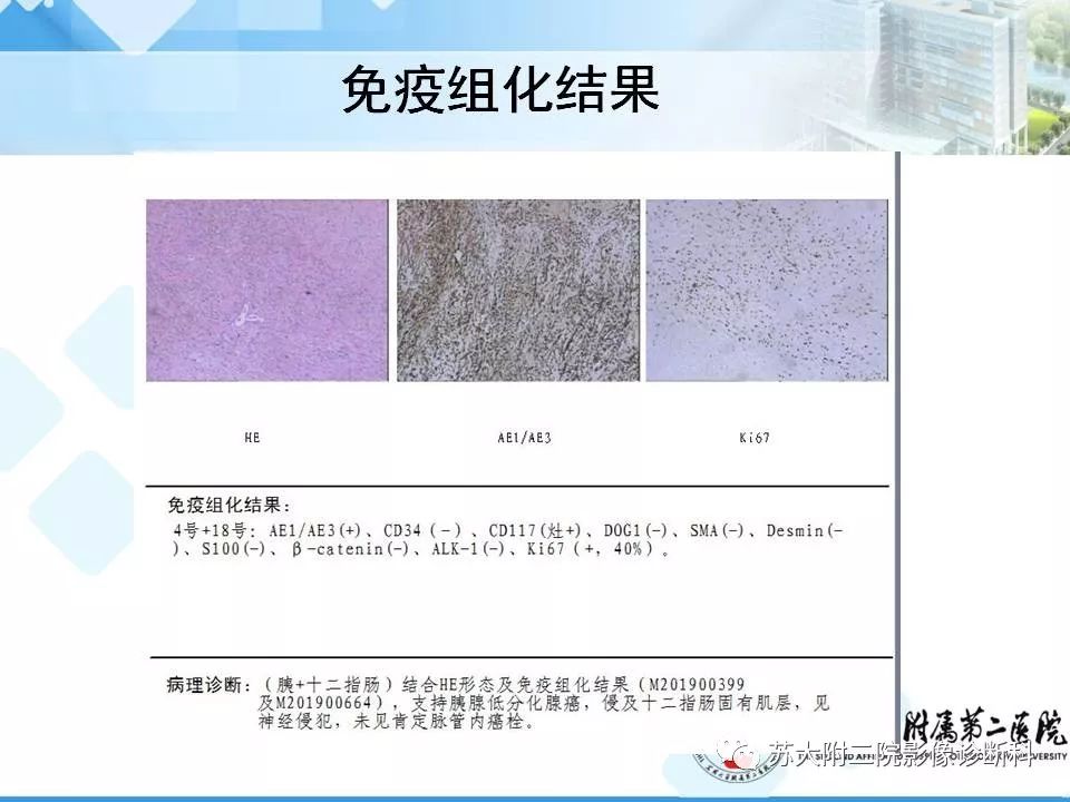 影像PPT - 【病例】胰腺囊性病变3例影像诊断-30