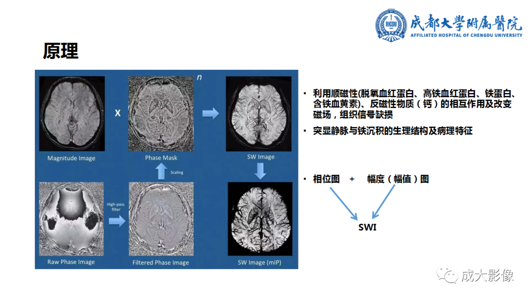 影像PPT - 【PPT】SWI在中枢神经系统疾病中的应用-2