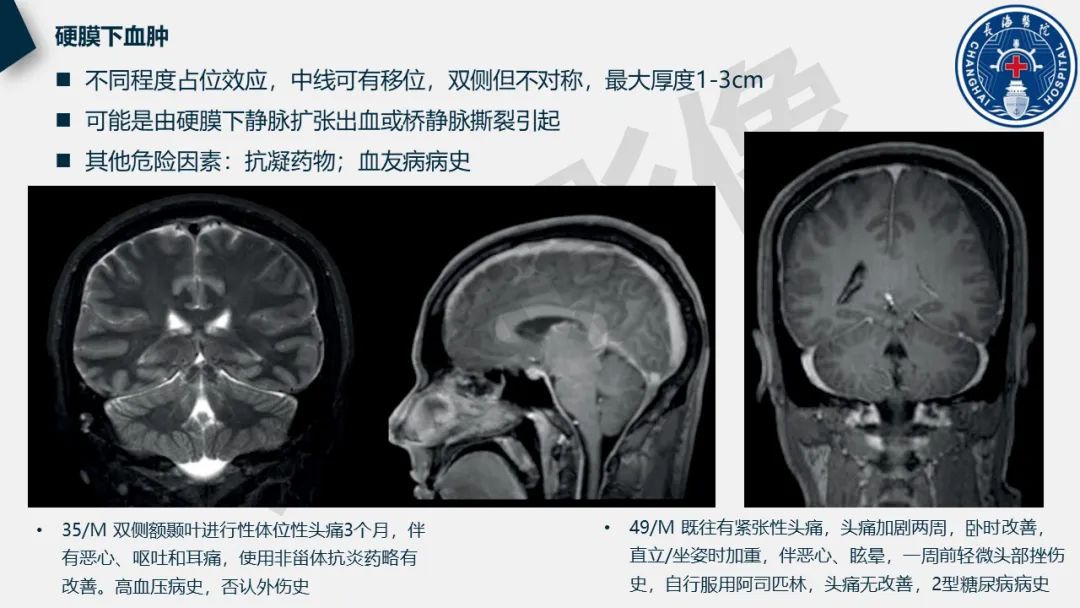 影像PPT - 【PPT】低颅压综合征-31