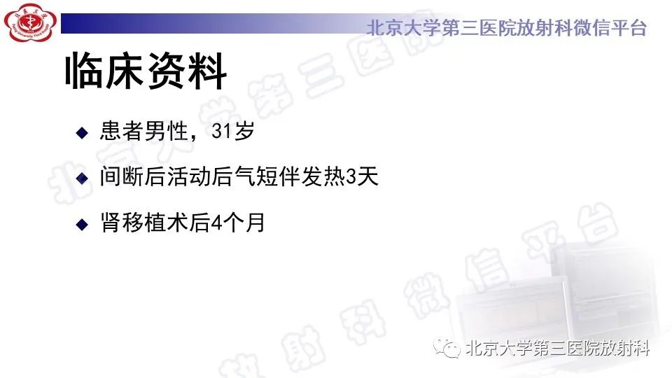 影像PPT - 【PPT】病毒性肺炎-2