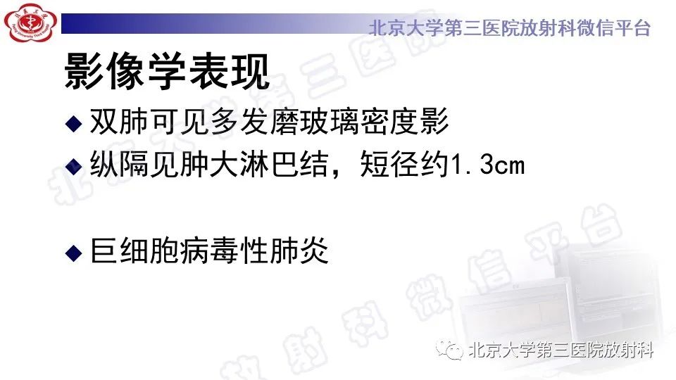 影像PPT - 【PPT】病毒性肺炎-9