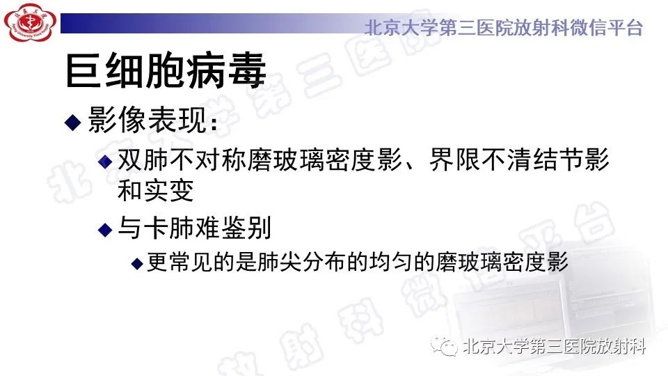 影像PPT - 【PPT】病毒性肺炎-16