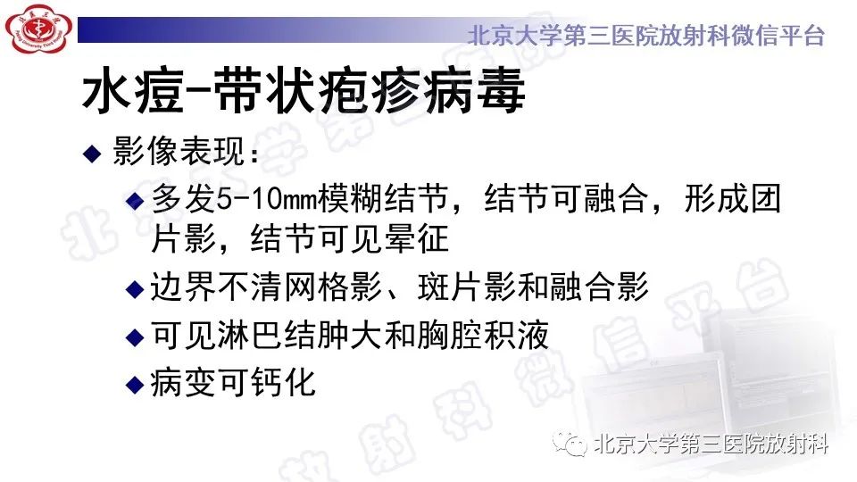 影像PPT - 【PPT】病毒性肺炎-35