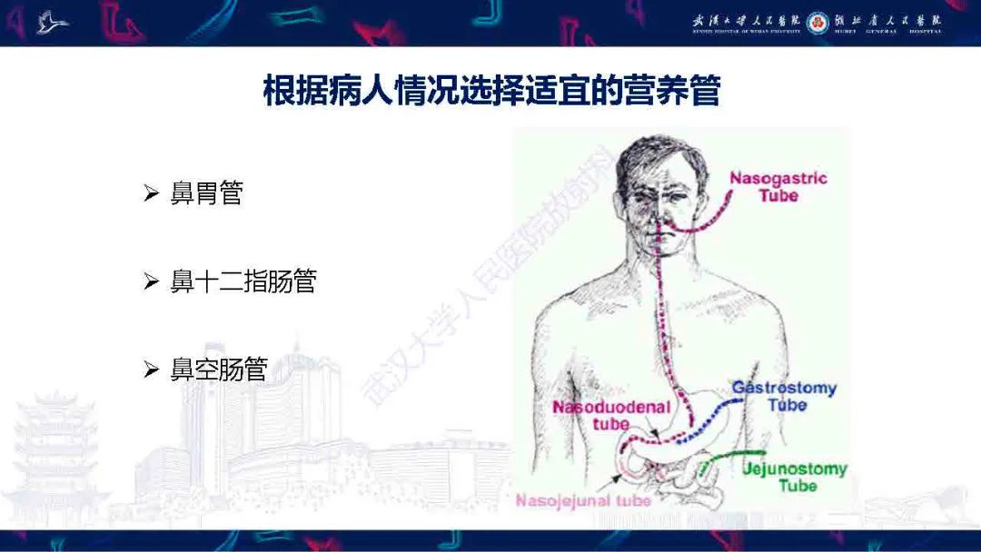影像PPT - 【PPT】胃肠营养管影像评估-4