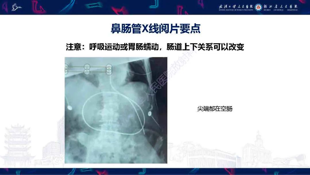 影像PPT - 【PPT】胃肠营养管影像评估-14