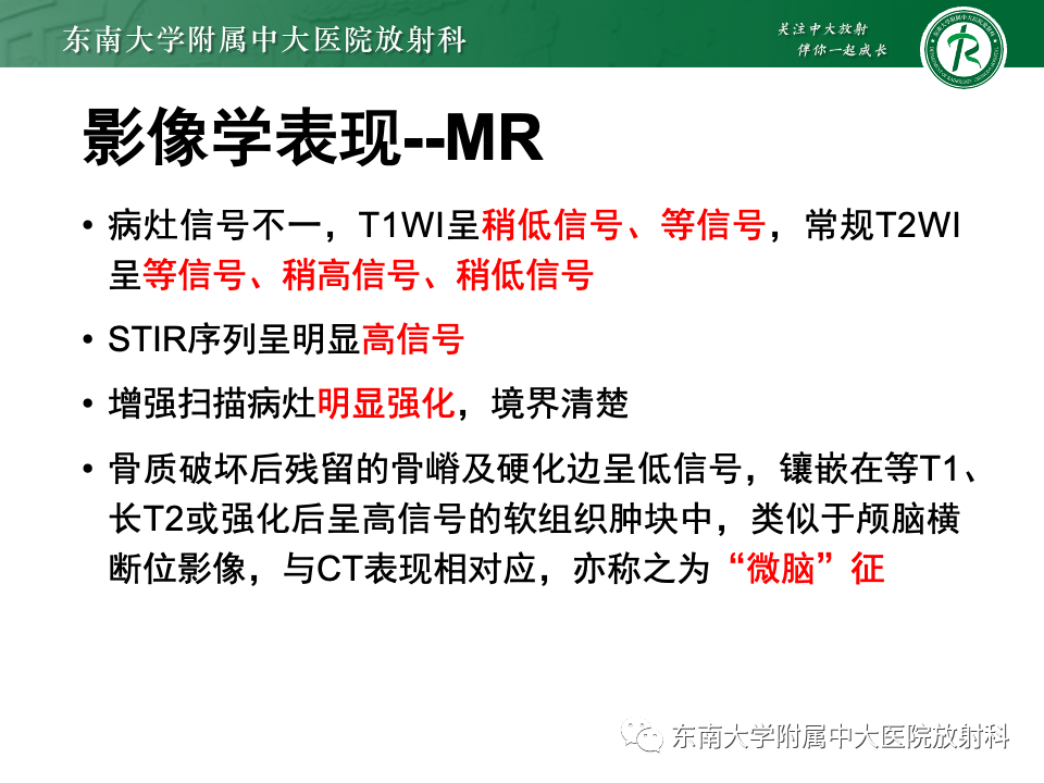 影像PPT - 【PPT】骨孤立性浆细胞瘤-13
