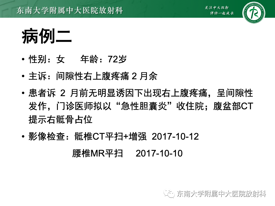 影像PPT - 【PPT】骨孤立性浆细胞瘤-16