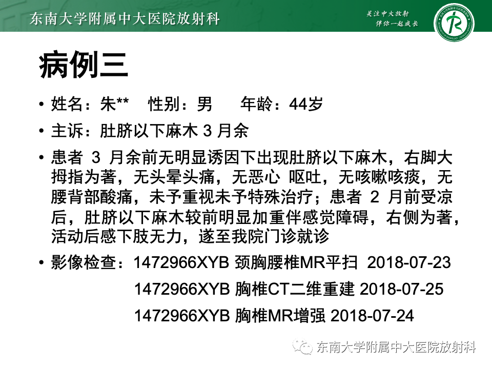 影像PPT - 【PPT】骨孤立性浆细胞瘤-21