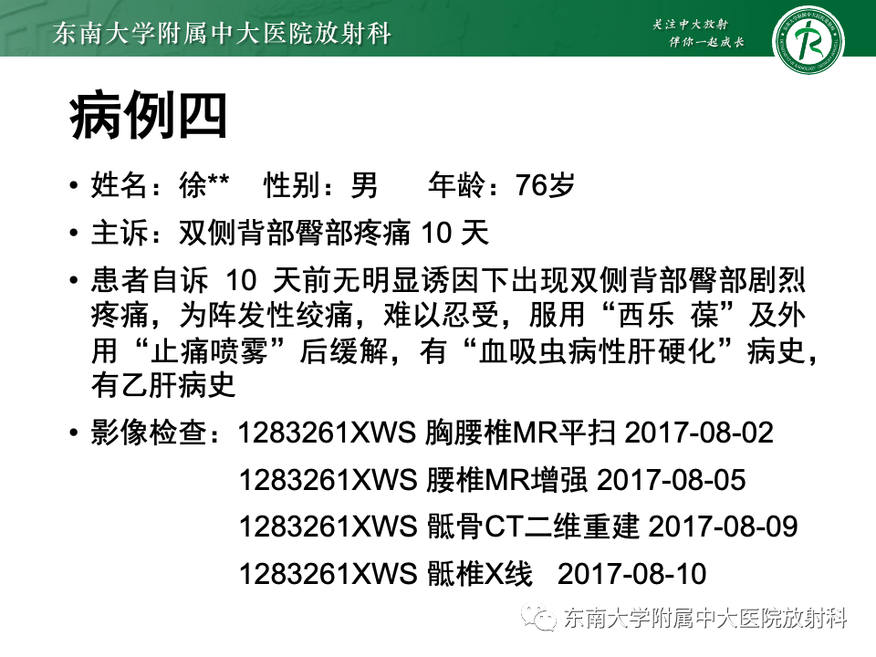 影像PPT - 【PPT】骨孤立性浆细胞瘤-26
