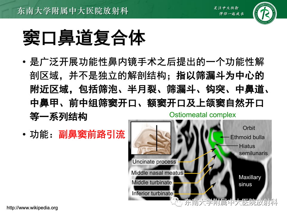 影像PPT - 【PPT】真菌性鼻窦炎-6