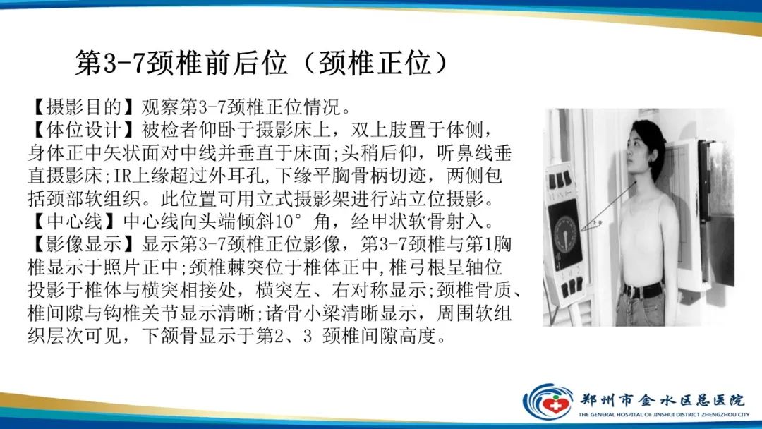 影像PPT - 【PPT】颈椎拍片技术与临床意义-10