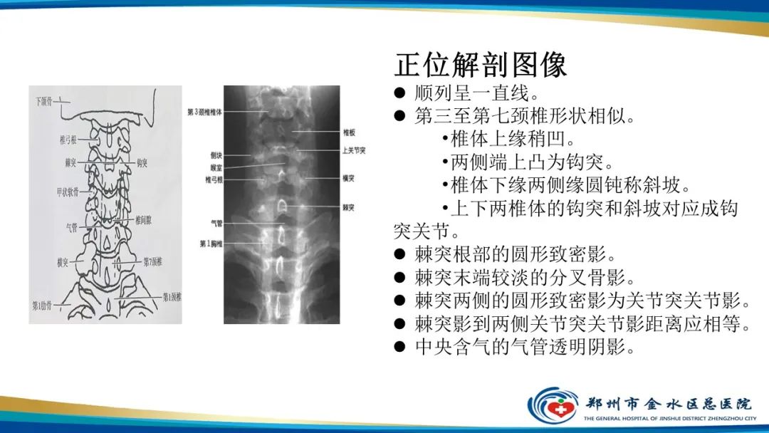 影像PPT - 【PPT】颈椎拍片技术与临床意义-11