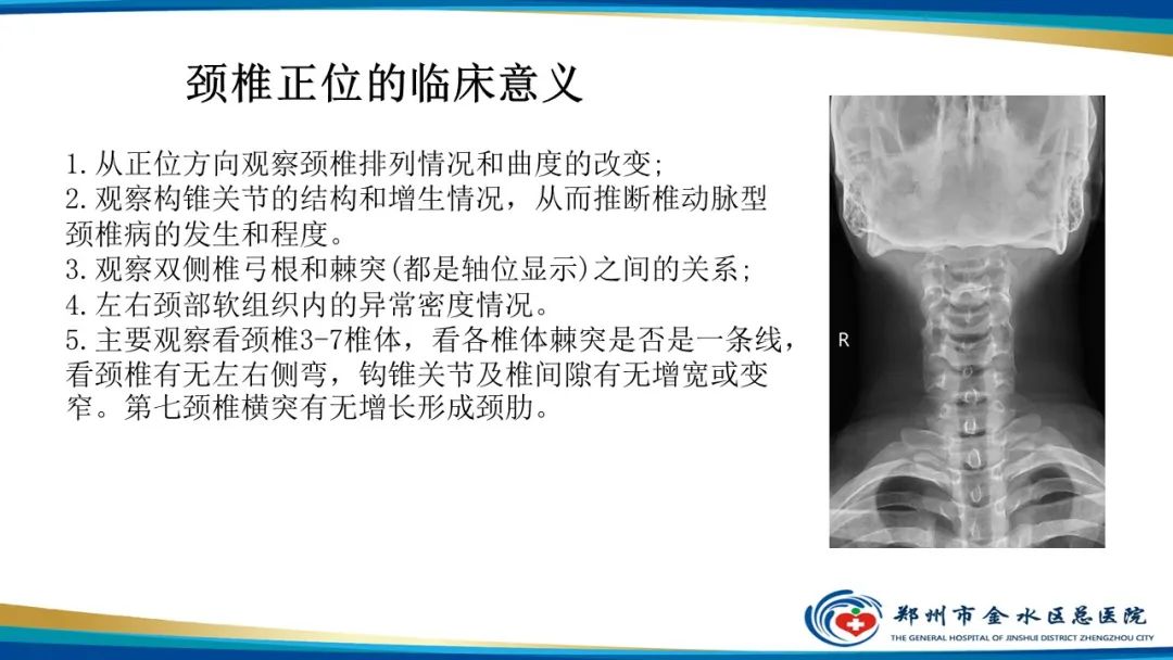 影像PPT - 【PPT】颈椎拍片技术与临床意义-12
