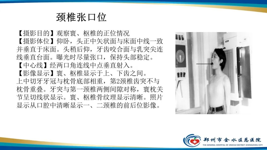影像PPT - 【PPT】颈椎拍片技术与临床意义-13